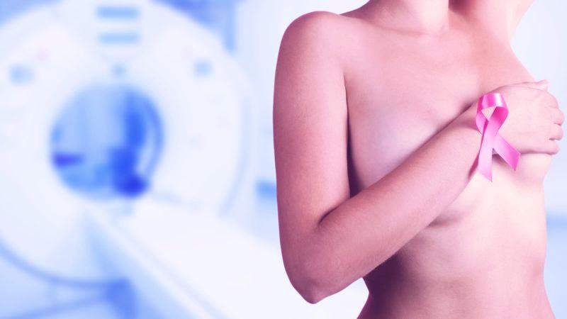 Como Deep learning pode auxiliar no diagnóstico e prevenção do cancer de mama .